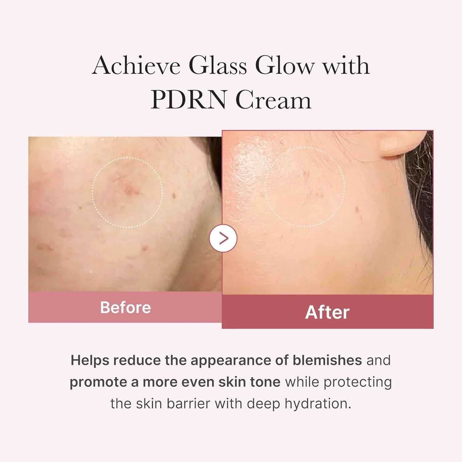 Medicube – Crema Hidratante PDRN Pink con Ácido Hialurónico 50ml – Regeneración y Luminosidad
